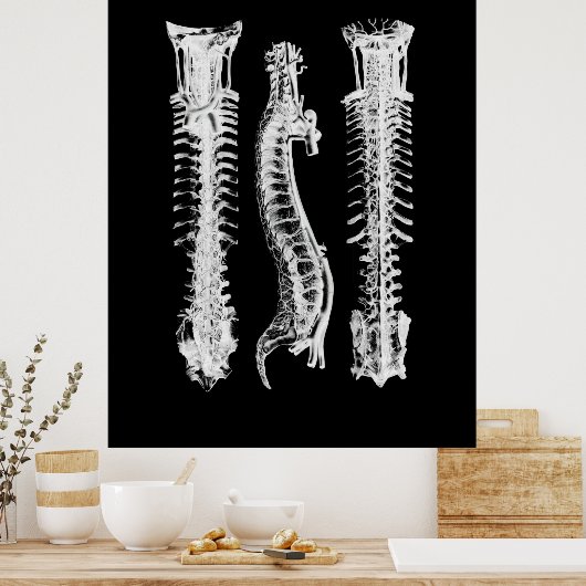 Kunst met anatomie van wervelkolom poster (Keuken)