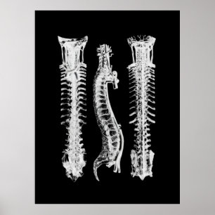 Kunst met anatomie van wervelkolom poster