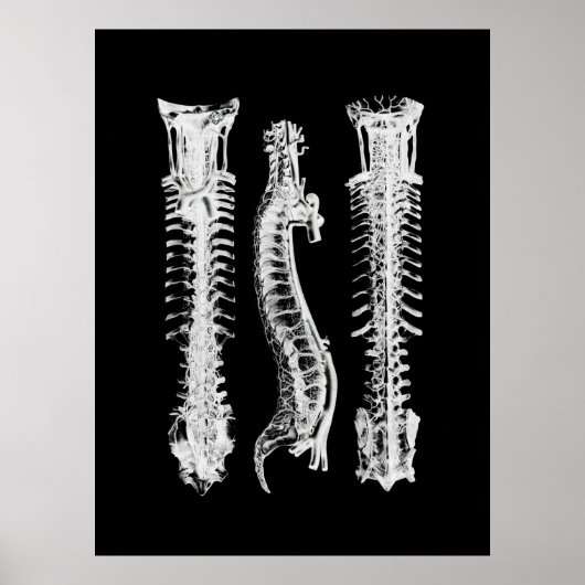 Kunst met anatomie van wervelkolom poster (Voorkant)