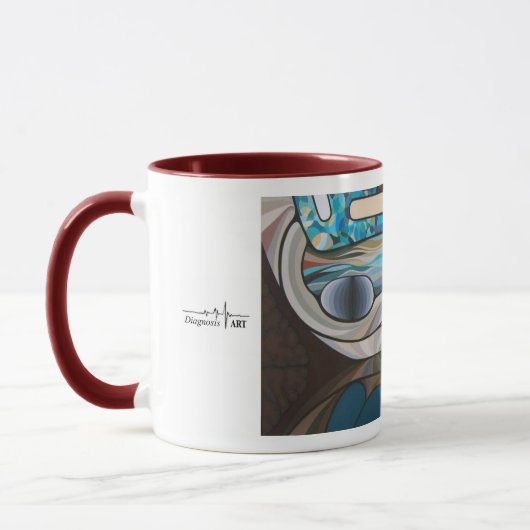 Kunst voor artsen! Sinuschirurgie Mok (Links)