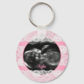 Lacy Pink Ultrasound Sleutelhanger (Voorkant)