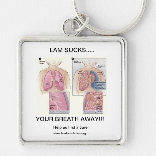 LAM SUCKS SLEUTELHANGER (Voorkant)