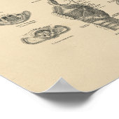  Larynx Anatomy 1880 Afdruk Poster (Hoek)