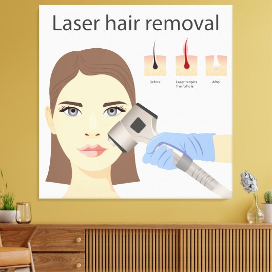 Laser ontharingsstructuur canvas afdruk (Insitu (Woonkamer))