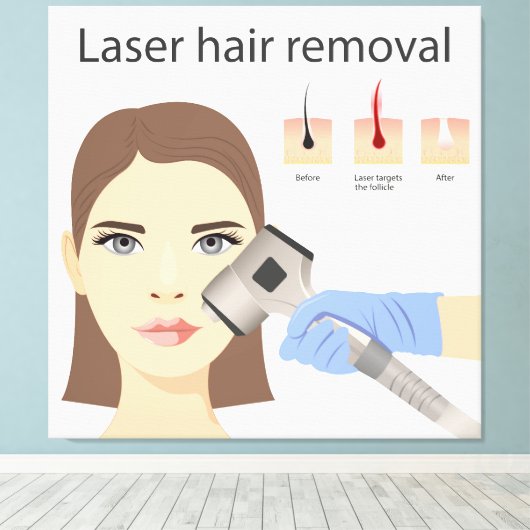 Laser ontharingsstructuur canvas afdruk (Insitu (Houten vloer))