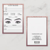 Lash Client Record Logo-Visitekaartje toevoegen Visitekaartje (Voorkant / Achterkant)