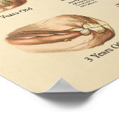 Leeftijd van het paard aangegeven door de Teth Cha Poster (Hoek)