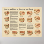 Leeftijd van het paard aangegeven door de Teth Cha Poster (Voorkant)