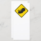 Let op: Baby Vooruit! (Voorkant / Achterkant)