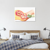 Levering foetus met vacuümextractie canvas afdruk (Insitu (Slaapkamer))