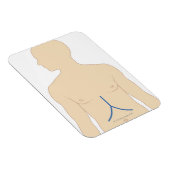 Levertransplantatie Magneet (Rechterzijde)