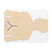 Levertransplantatie Magneet (Horizontaal)