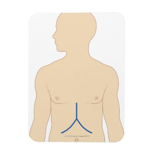 Levertransplantatie Magneet (Verticaal)