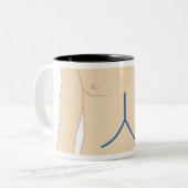 Levertransplantatie Tweekleurige Koffiemok (Voorkant links)