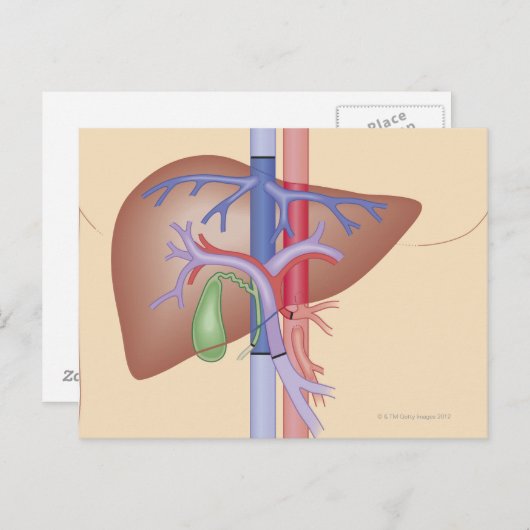 Levertransplantatieprocedure Briefkaart (Voorkant / Achterkant)