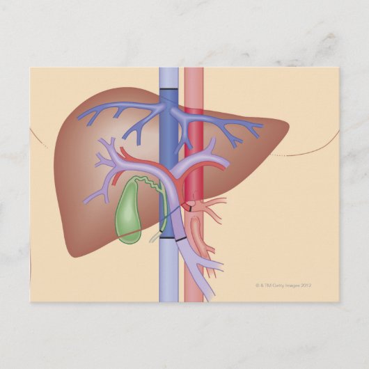 Levertransplantatieprocedure Briefkaart (Voorkant)
