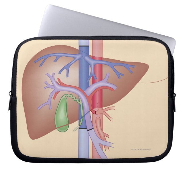 Levertransplantatieprocedure Laptop Sleeve (Voorkant)