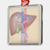 Levertransplantatieprocedure Metalen Ornament (Links)