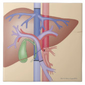 Levertransplantatieprocedure Tegeltje (Voorkant)