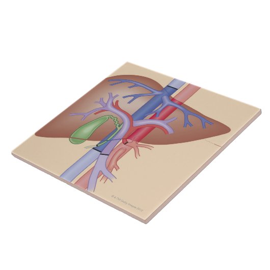 Levertransplantatieprocedure Tegeltje (Zijkant)
