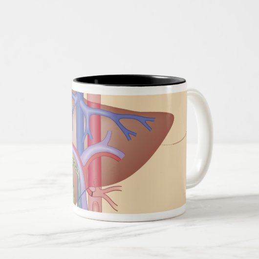 Levertransplantatieprocedure Tweekleurige Koffiemok (Voorkant rechts)