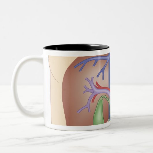 Levertransplantatieprocedure Tweekleurige Koffiemok (Links)