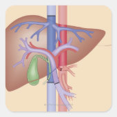Levertransplantatieprocedure Vierkante Sticker (Voorkant)