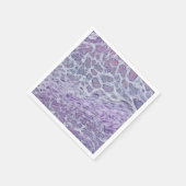 Lila acrylvezel Abstracte vloeisel Servet (Hoek)