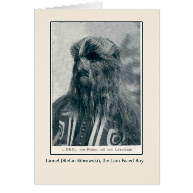 Lionel, de Lion Faced Boy Kaarten en Briefkaarten (Voorkant)