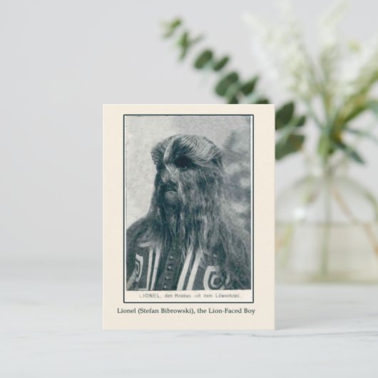 Lionel, de Lion Faced Boy Kaarten en Briefkaarten (Staand voorkant)