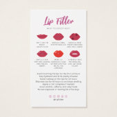 Lipvuller Lipinjecties Nazorg Kaart Niet doen (Achterkant)