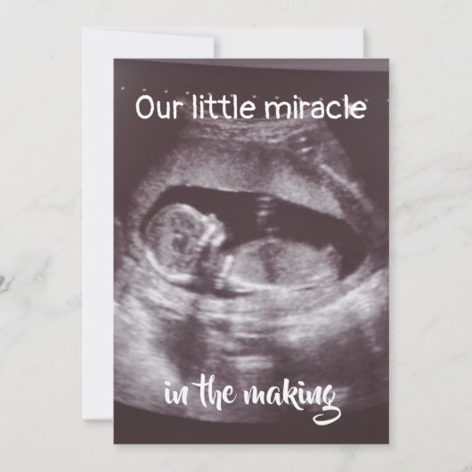Little Miracle Ultrasound 2 foto Baby familie Aankondiging (Voorkant)