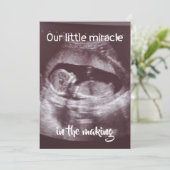 Little Miracle Ultrasound 2 foto Baby familie Aankondiging (Staand voorkant)