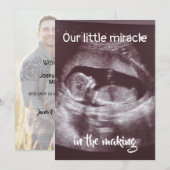 Little Miracle Ultrasound 2 foto Baby familie Aankondiging (Voorkant / Achterkant)
