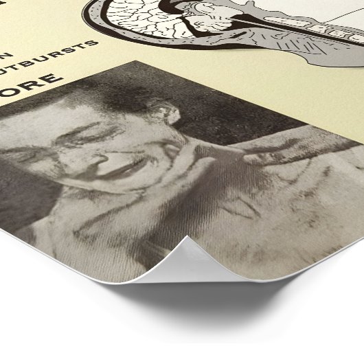 Lobotomie Adverteren Poster | Vintage advertentie  (Hoek)
