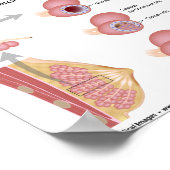 Lobulaire borstkanker, met een schema. poster (Hoek)