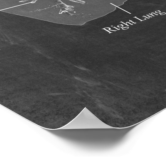 Longanatomie Trachea en Bronchi Poster (Hoek)