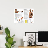 Longmeridiaan Acupunctuurpunten Poster (Thuiskantoor)