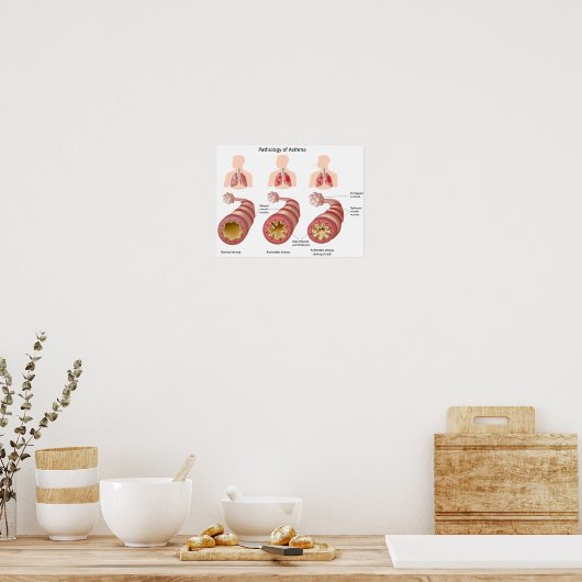 Longziekte Astma Poster (Keuken)