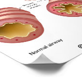 Longziekte Astma Poster (Hoek)