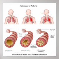 Longziekte Astma Poster