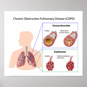 Longziekte (COPD) Poster