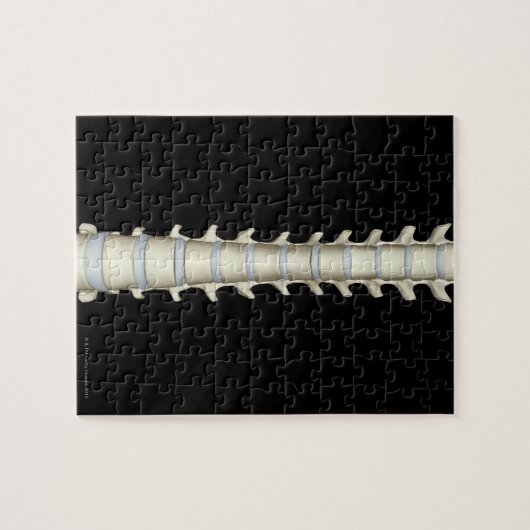 Lumbar en Thoracic Vertebrae Legpuzzel (Horizontaal)