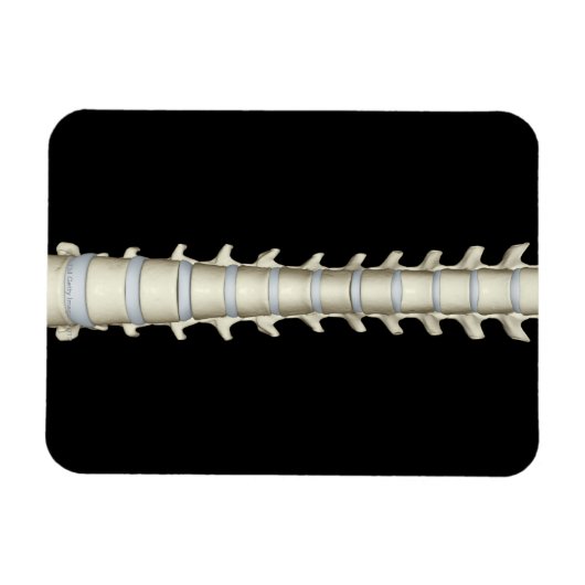 Lumbar en Thoracic Vertebrae Magneet (Horizontaal)