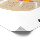 Lumbar Spinale Stenosis, medische tekening. Poster (Hoek)