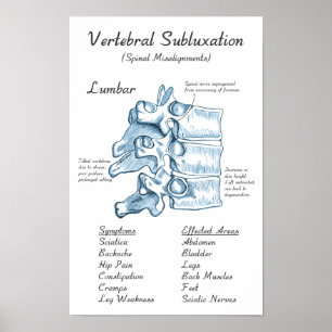 Lumbar Subluxation Chiropractic Art Poster