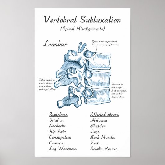Lumbar Subluxation Chiropractic Art Poster (Voorkant)