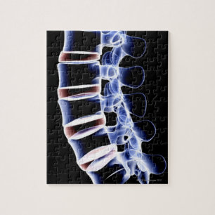 Lumbar Vertebrae 2 Legpuzzel
