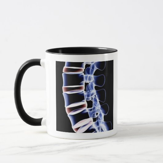 Lumbar Vertebrae 2 Mok (Links)