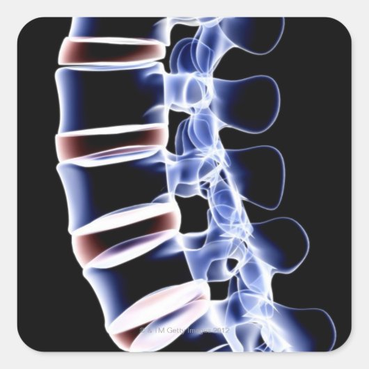 Lumbar Vertebrae 2 Vierkante Sticker (Voorkant)
